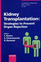Cover of Kidney Transplantation: Strategies to Prevent Organ Rejection